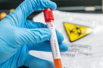 9f8ffe8 coronavirus covid 19 tube test 233 chantillon main positif 1211795483 scaled 1 - На Прикарпатті за добу виявили понад 600 випадків захворювання на COVID-19 - rai.ua