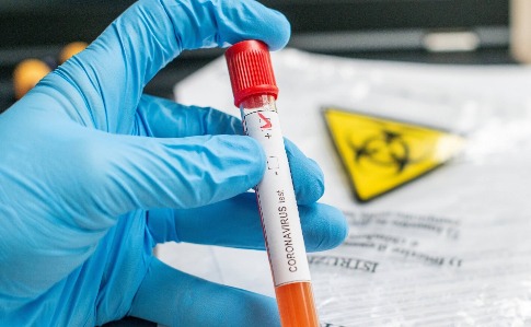 9f8ffe8 coronavirus covid 19 tube test 233 chantillon main positif 1211795483 scaled 1 - На Прикарпатті за добу виявили понад 600 випадків захворювання на COVID-19 - rai.ua