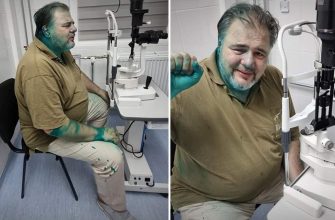 image 3 - В Івано-Франківську облили зеленкою проросійського журналіста Коцабу. Відео - rai.ua