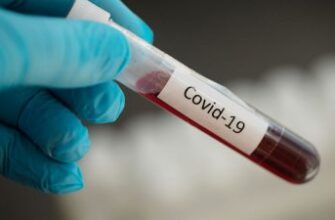 covid 19 21 400x225 1 - ВООЗ: понад 1 млн людей померло від COVID у 2022 році. Відео - rai.ua