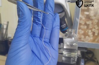 На Рівненщині лікарі видалили з ока жінки 11-сантиметрового гельмінта