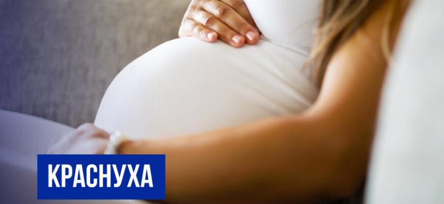 Краснуха: чим небезпечна легка висипка для майбутніх мам та їхніх малюків?