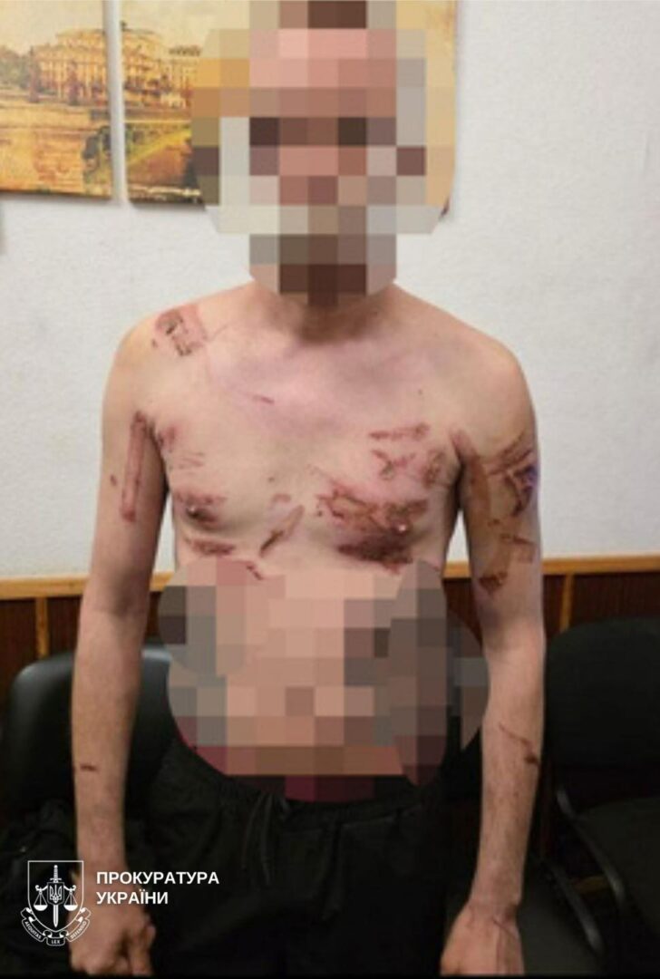 iuig - Три дні у підвалі та катування паяльником: у Кривому Розі судитимуть викрадачів - rai.ua