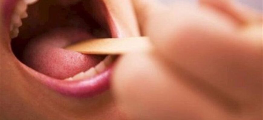 mrysdb - Дифтерія — це бактеріальна інфекція, що уражає дихальні шляхи, горло та шкіру - rai.ua