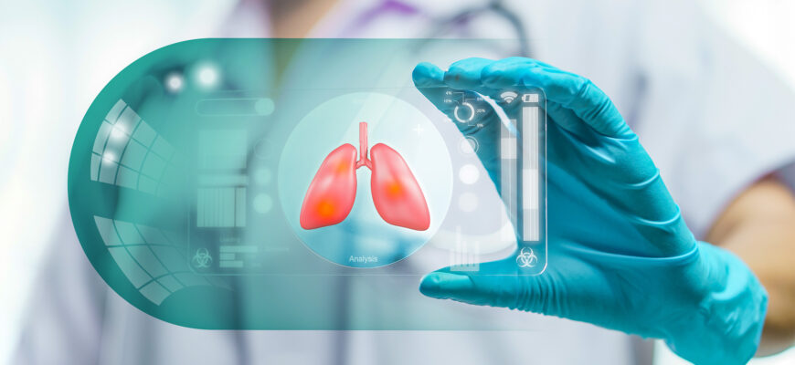 Березень в Україні традиційно присвячений подоланню туберкульозу