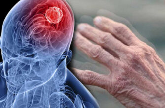 1-2% осіб старше 65 років зіштовхуються з хворобою Паркінсона