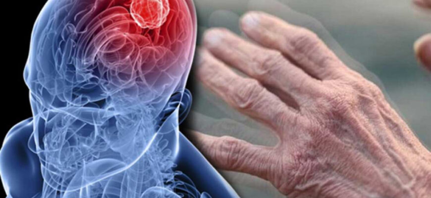 1-2% осіб старше 65 років зіштовхуються з хворобою Паркінсона