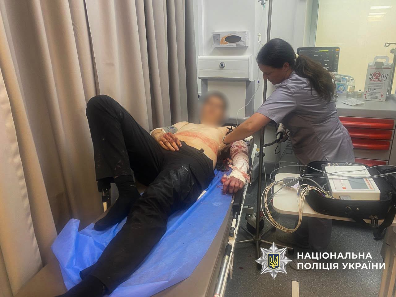 a6shshch - Озброєний напад на поліцейських у Запоріжжі: нападник помер - rai.ua