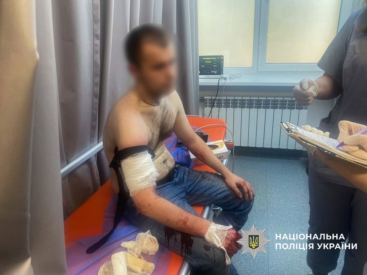 oshchrzh - Озброєний напад на поліцейських у Запоріжжі: нападник помер - rai.ua