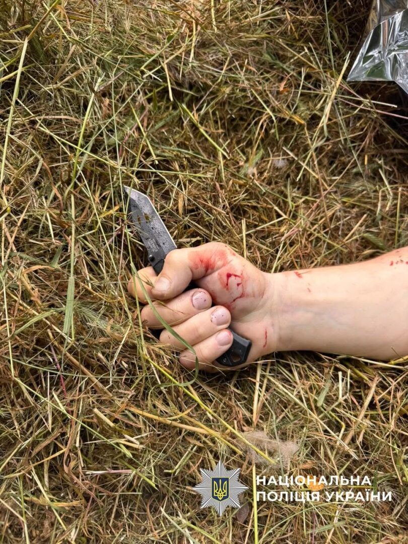 ryshzhrzh - Озброєний напад на поліцейських у Запоріжжі: нападник помер - rai.ua