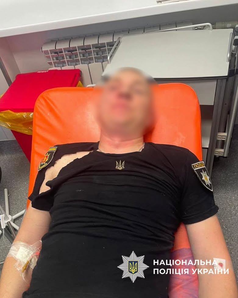 shdrzh - Озброєний напад на поліцейських у Запоріжжі: нападник помер - rai.ua