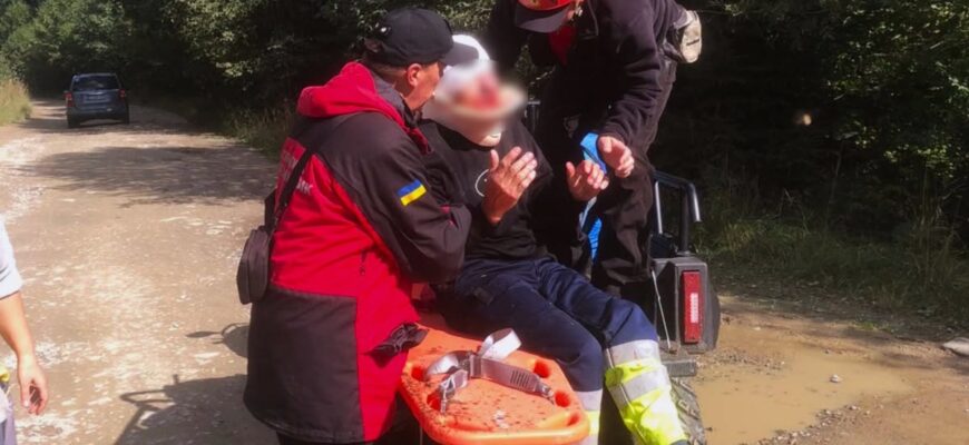 Упав з гойдалки: рятувальники допомогли травмованому чоловікові