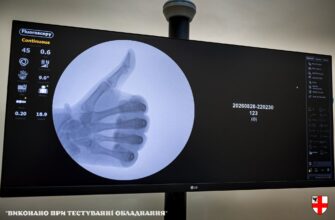 Карпатський Шпиталь отримав сучасний рентген-діагностичний комплекс